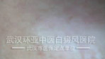 人ҽҽԺ